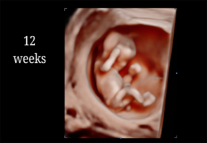 12 Weeks