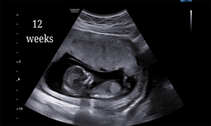 12 Weeks
