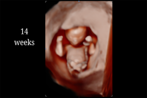 14 Weeks