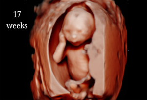 17 Weeks