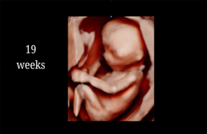 19 Weeks