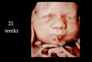 25 Weeks