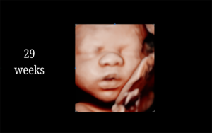 29 Weeks
