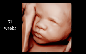 31 Weeks