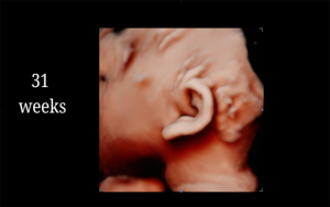 31 Weeks