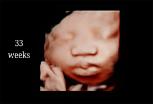 33 Weeks