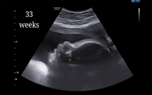 33 Weeks