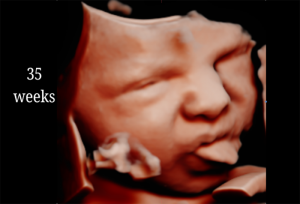 35 Weeks
