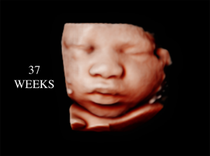 37 Weeks