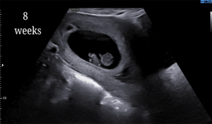 8 Weeks