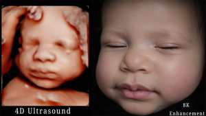 8k Image Enhancement