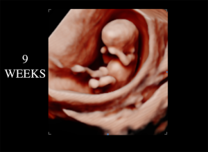 9 Weeks