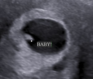 Pregnancy Confirmation