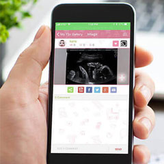 streaming ultrasound from phone